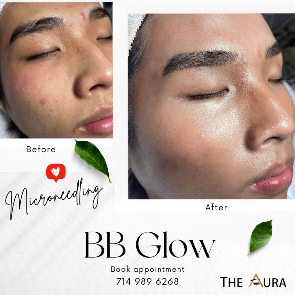 Update your skill with The latest treatment for skin - BB GLow Treatment. 🔖 Enroll in our BB Glow masterclass to be make great change in your career.